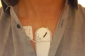 Le mini-patch connecté Multisense développé par RDS.